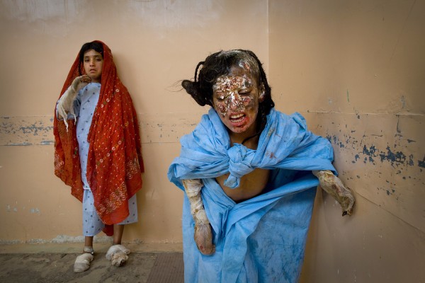 Image: Afghanistan's War Wounded Come To Mirwais Hospital in Kandahar